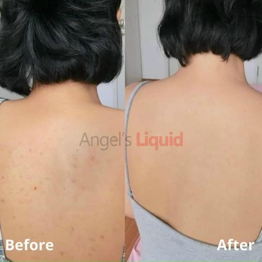 Angel’s Liquid - Glutathione Body Mist 150ml image 4