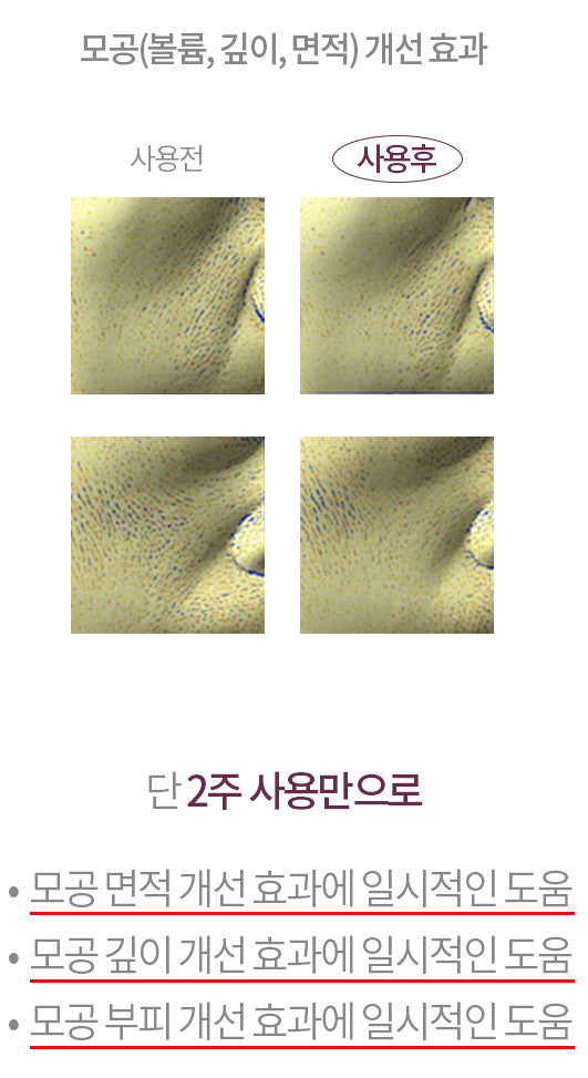 Kopher [4Ever Edition] Curepair Mela Cream (35ml) image 11