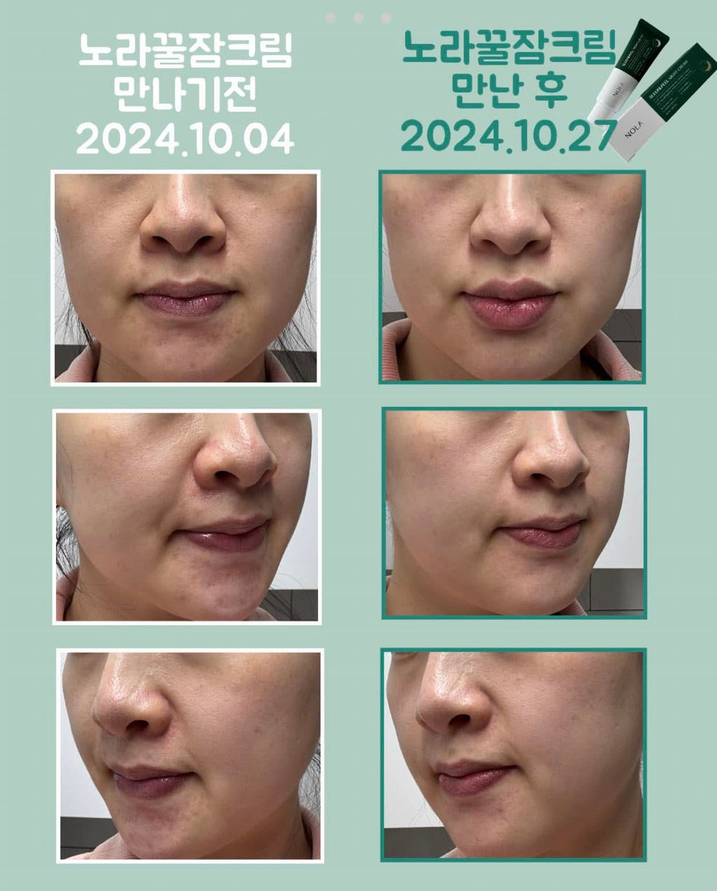 NOLA - SLEEP & PEEL NIGHT CREAM (50ml) image 6