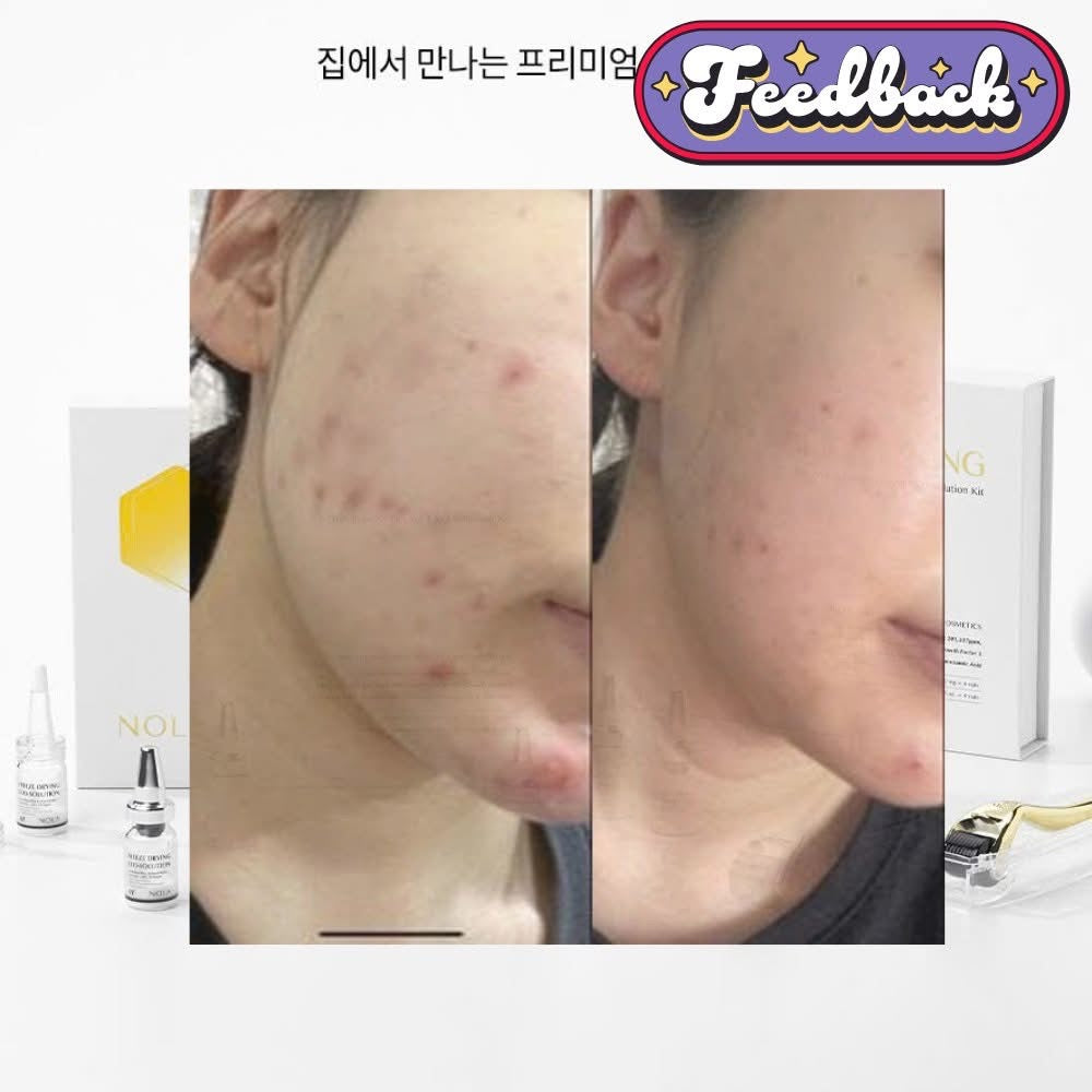 NOLA FREEZE DRYING EXO-SOLUTION KIT Brightening/ Anti-aging AMPOULE image 3