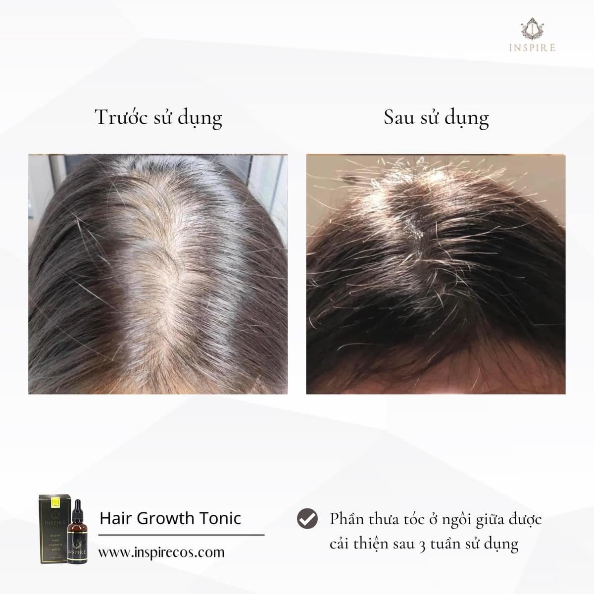 INSPIRE HAIR GROWTH TONIC - 50ml image 3