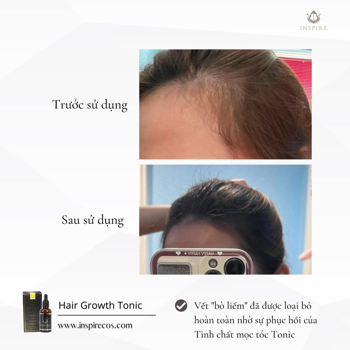 INSPIRE HAIR GROWTH TONIC - 50ml image 4