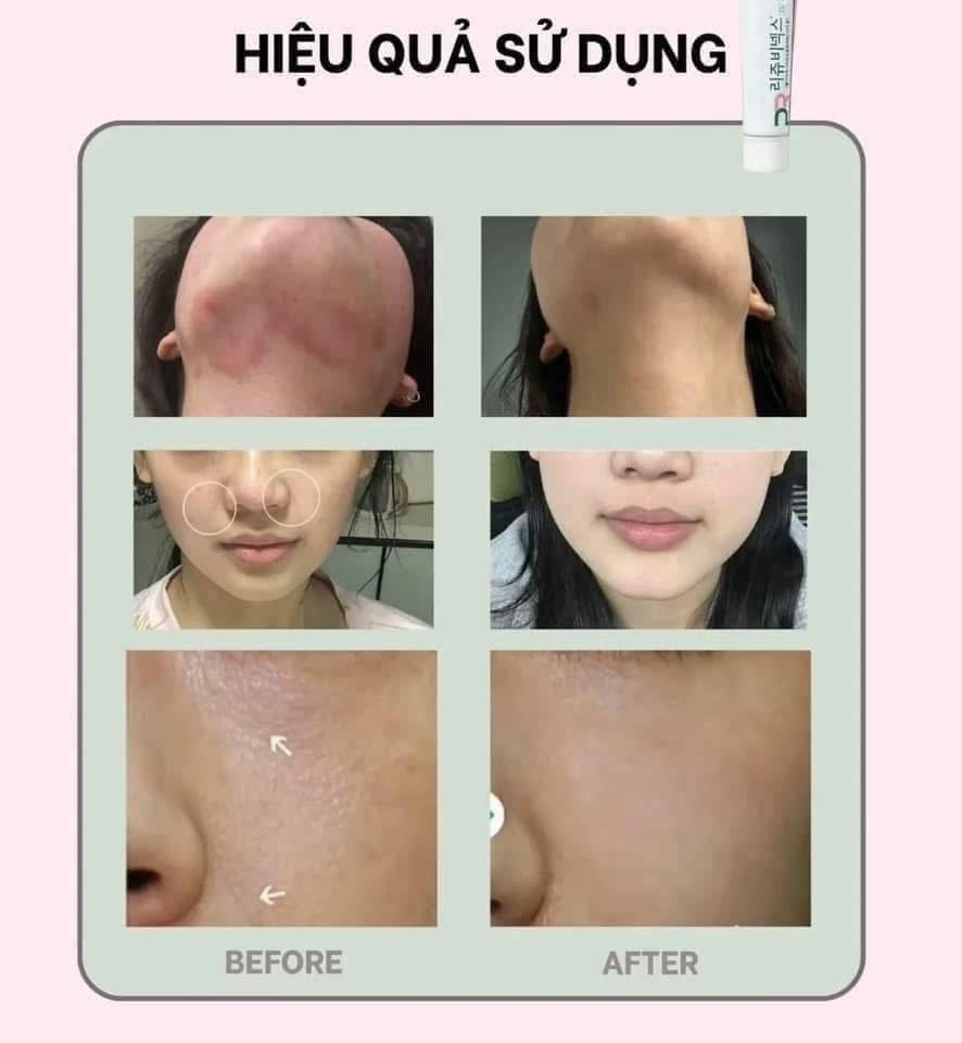 [PharmaResearch] Rejuvenex PDRN (10g) image 3