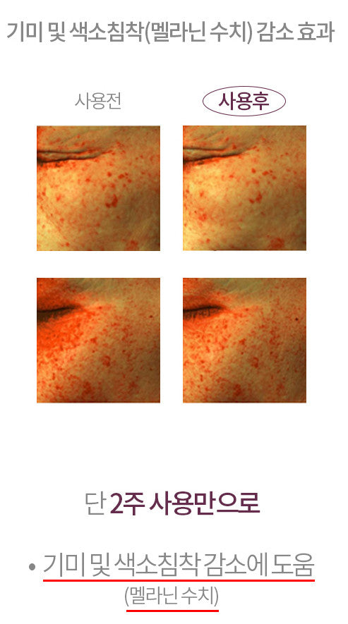 Kopher [4Ever Edition] Curepair Mela Cream (35ml) image 10