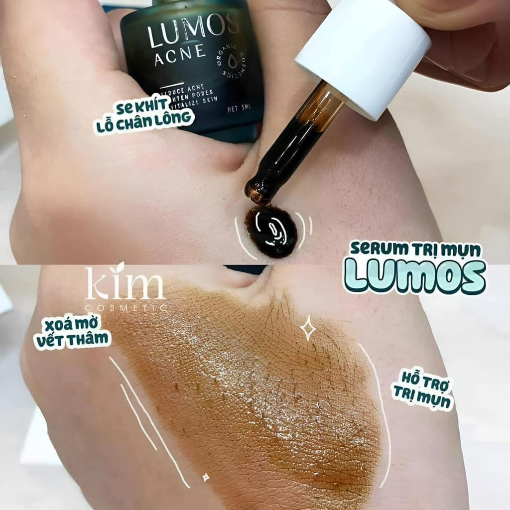 LUMOS - ACNE SERUM (5ml) image 6