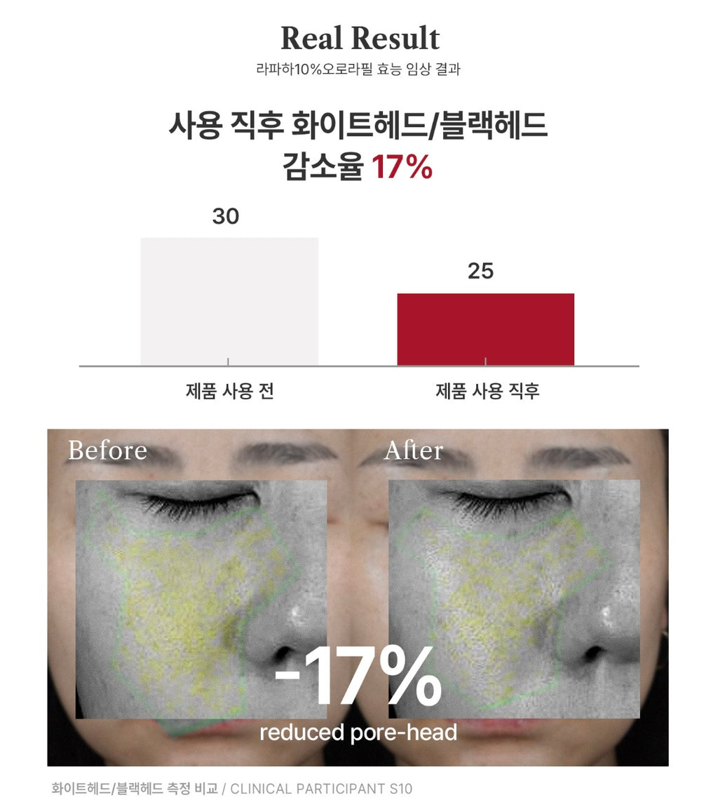 bravity - LHA,PHA, 10% AURORA PEEL (40ML) image 5